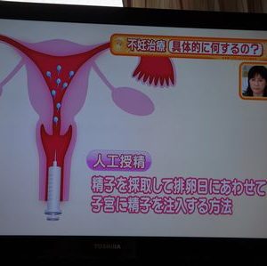 不妊治療について
